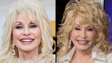 Dolly Parton Without Wig